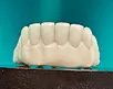 Zirconia Hybrid Custom Abutment